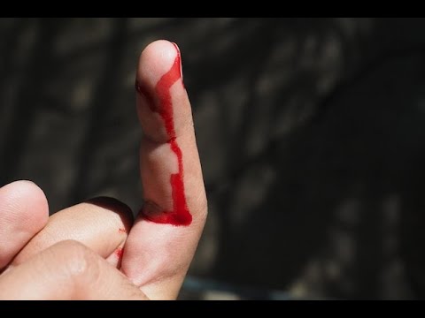 Addiction Outdoors Casting Trigger helps avoid cut fingers from fishing line